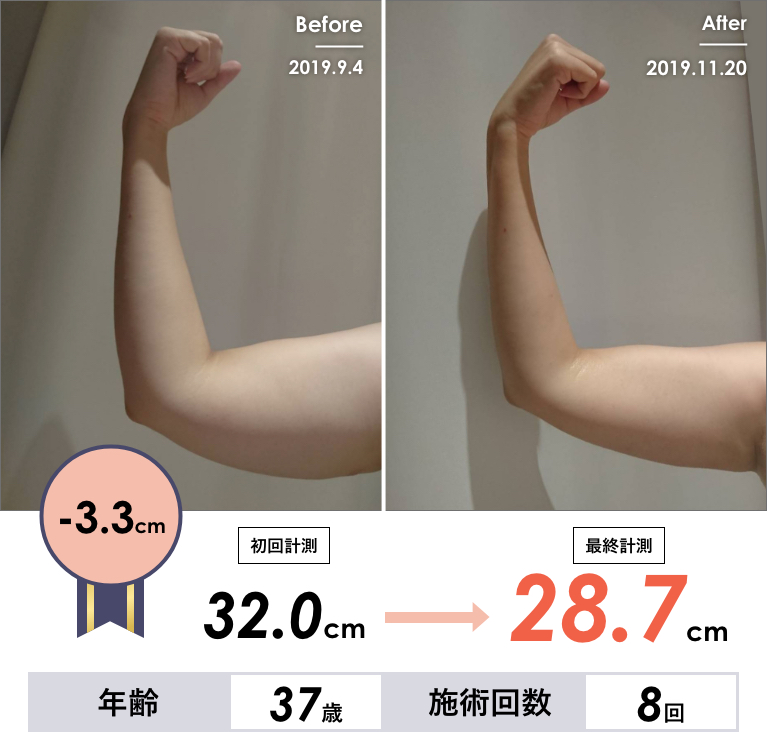 Before & After