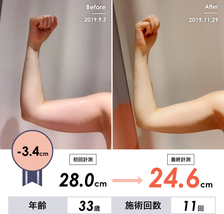 Before & After