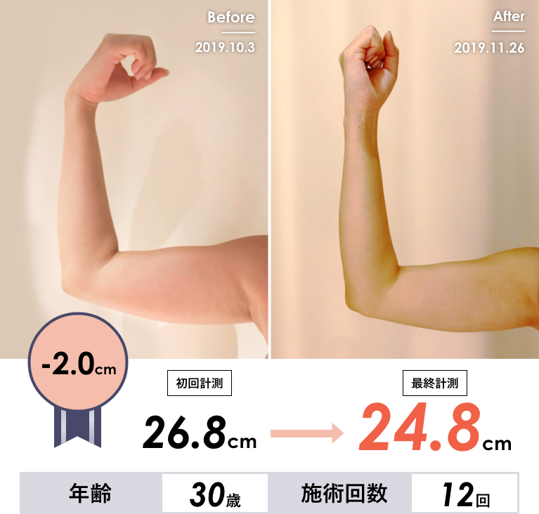 Before & After