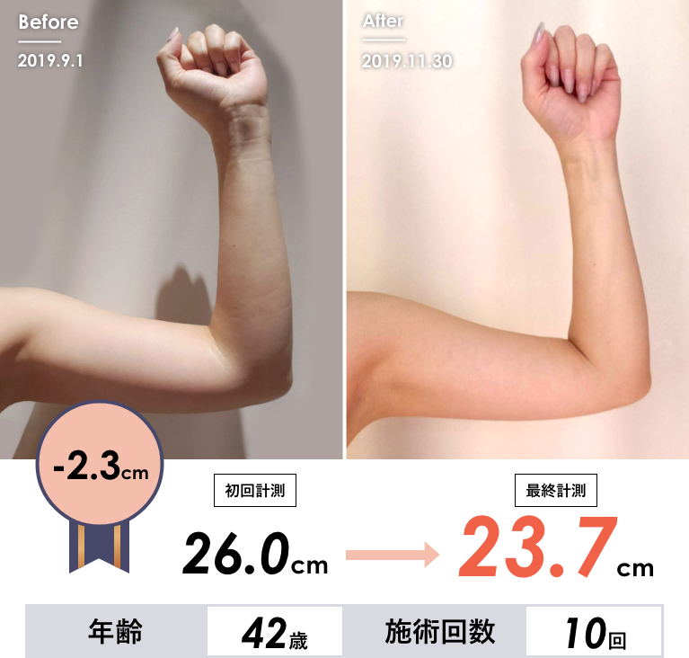 Before & After
