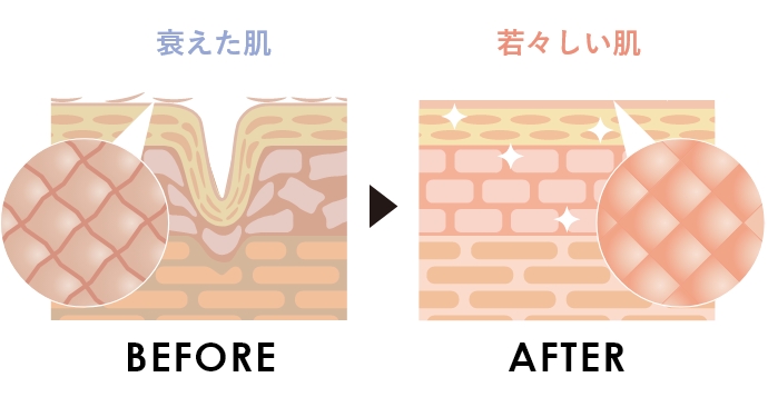 BEFORE / AFTER