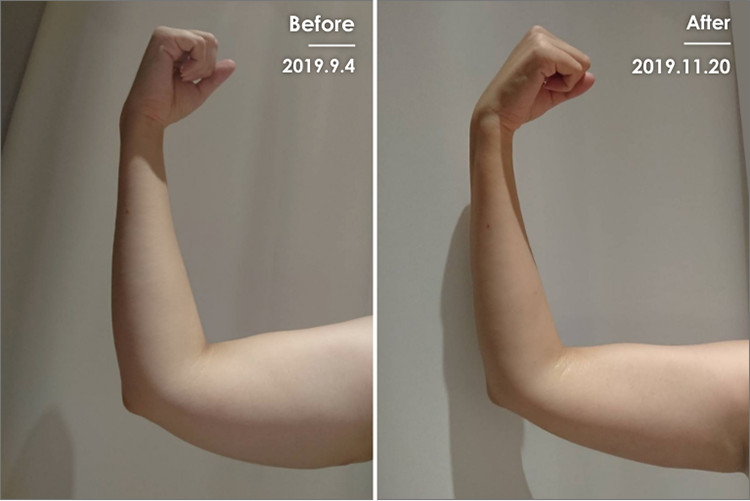 Before&After