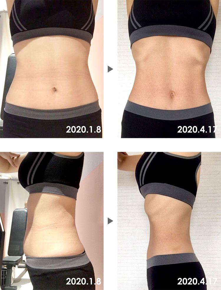 Before&After