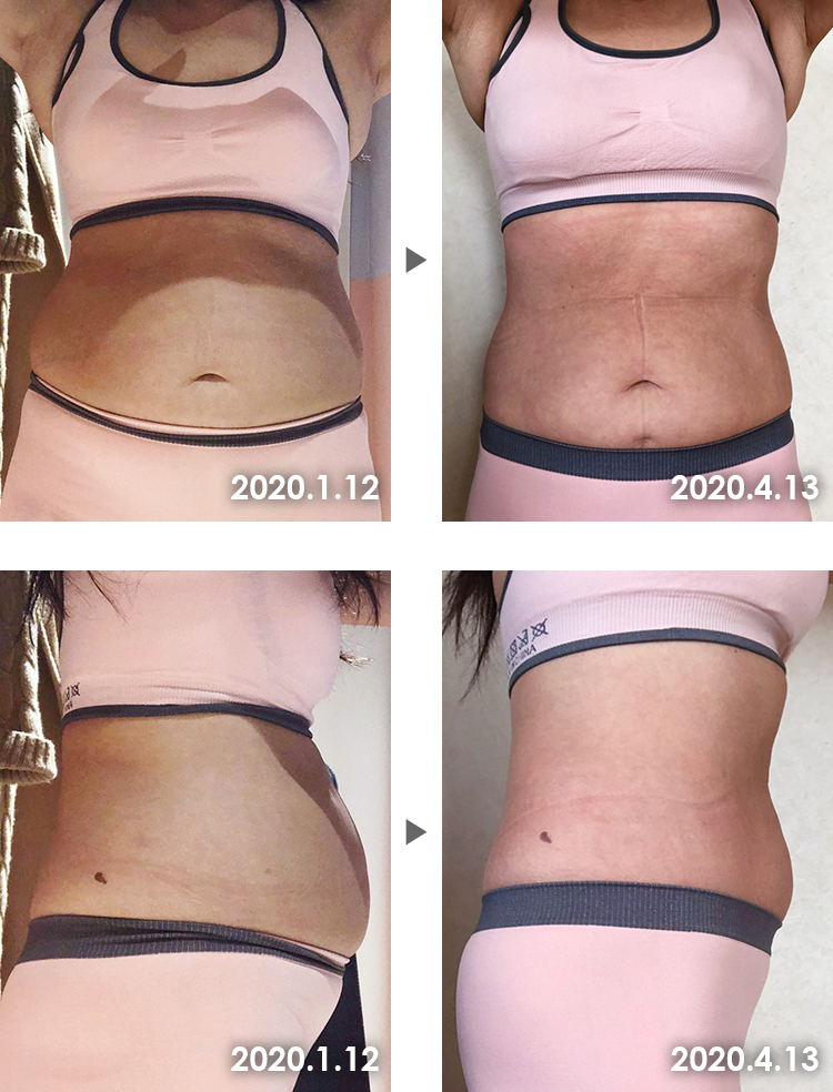 Before&After