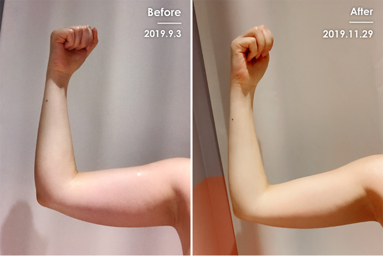 Before&After