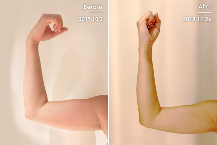 Before&After