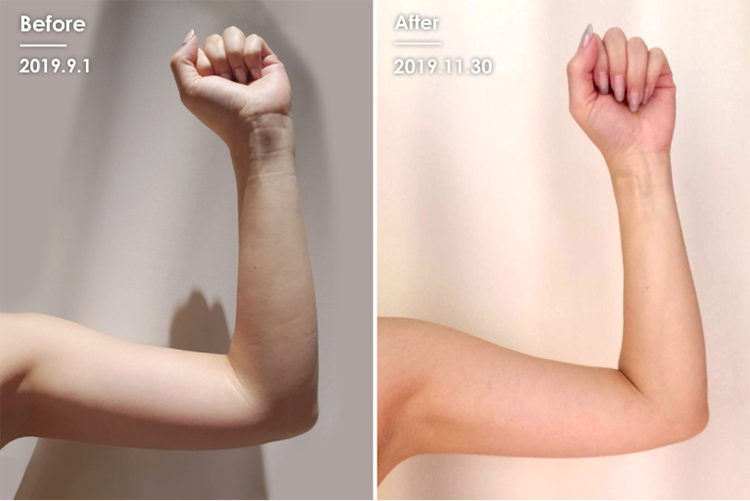 Before&After