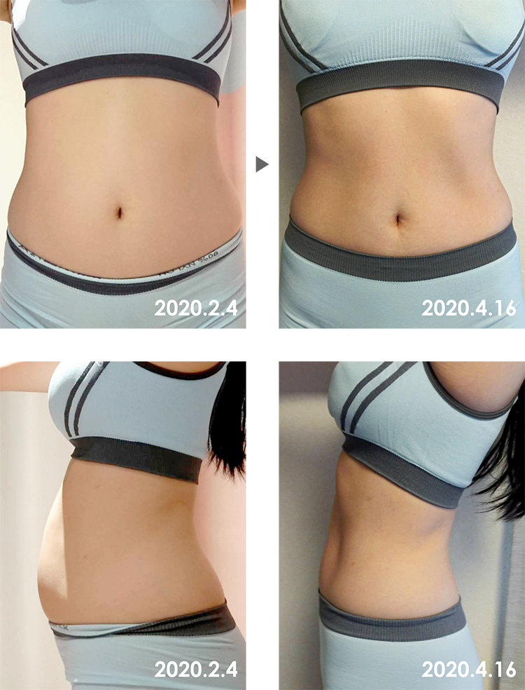Before&After