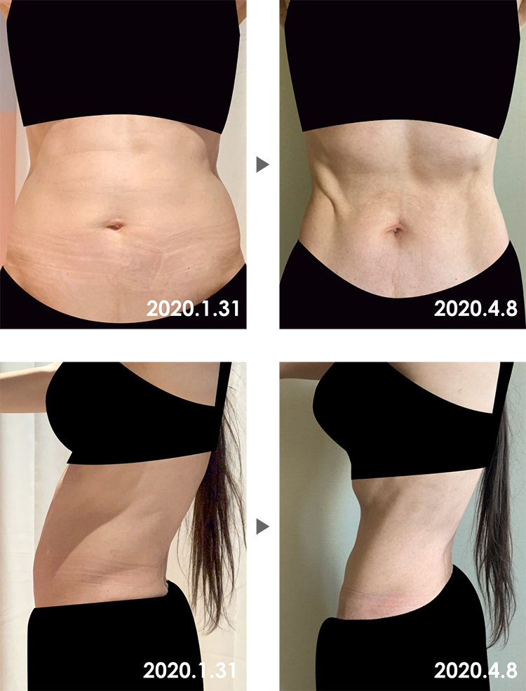 Before&After
