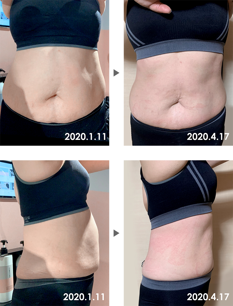 Before&After