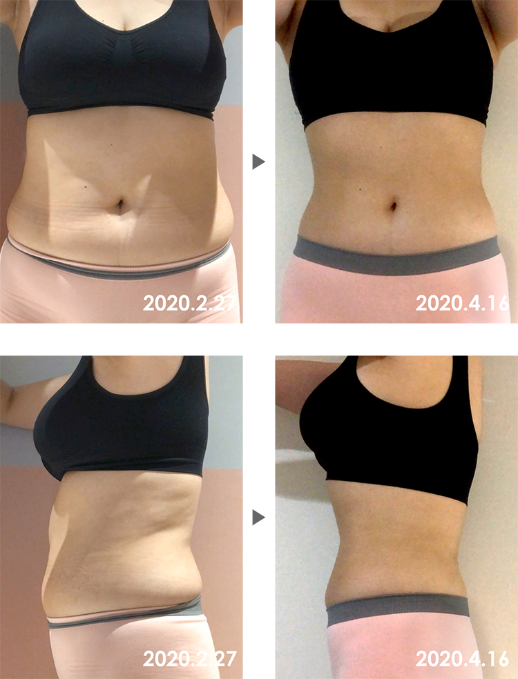 Before&After