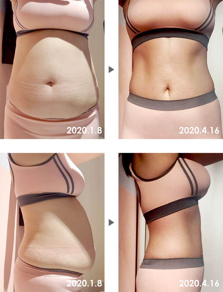 Before&After